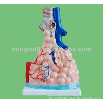 Enlarged Pulmonary Alveoli Model,Anatomical model